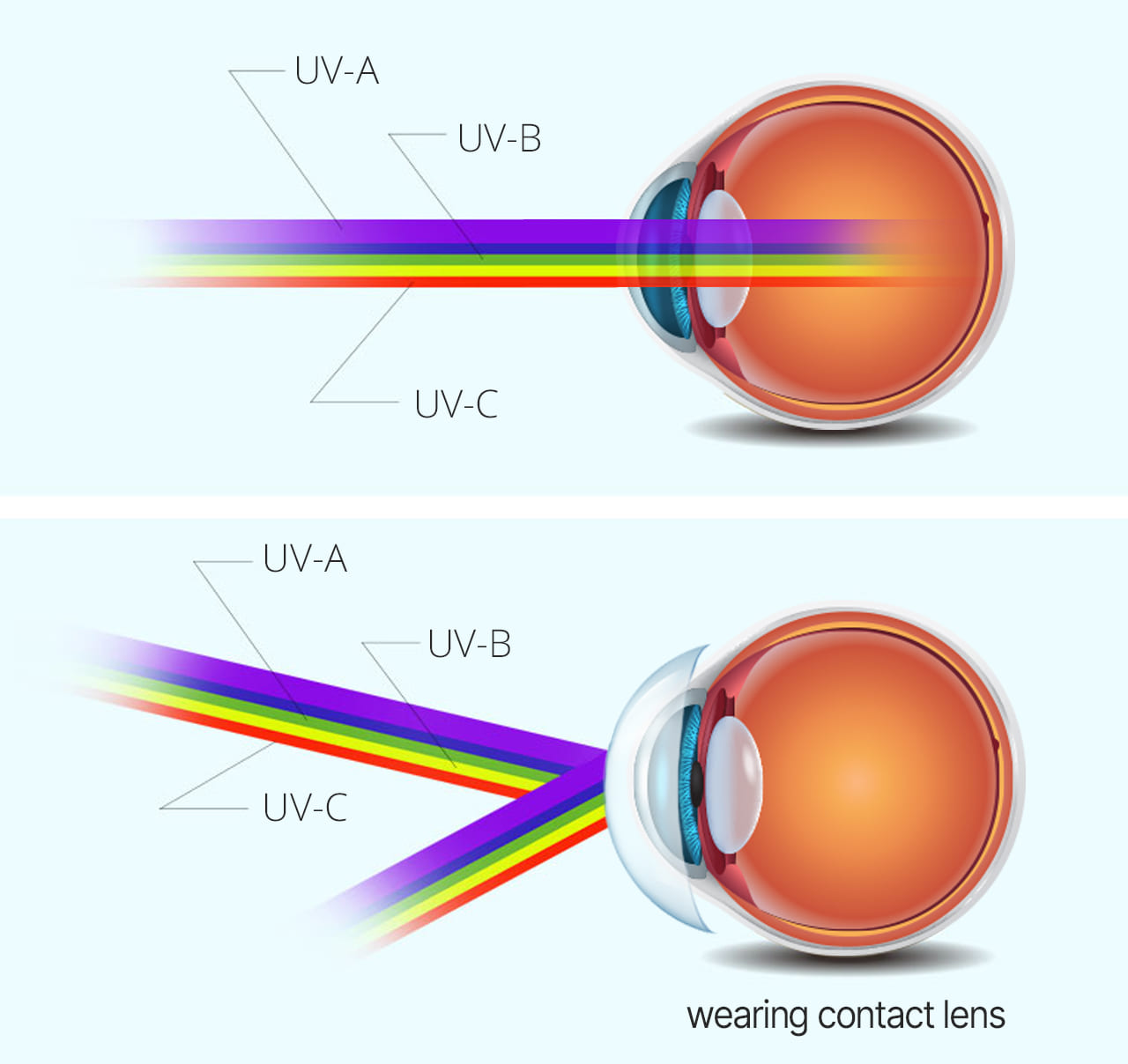 UV blocking by lens